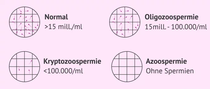 Imagen: Abweichungen in der Spermienkonzentration