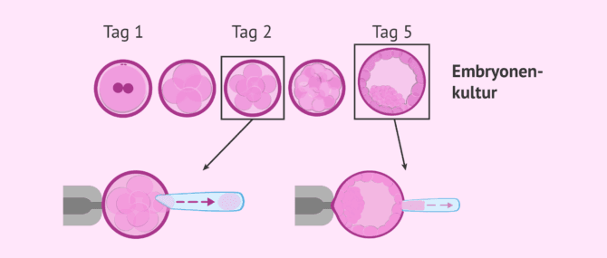 Imagen: Wann wird die Embryobiopsie durchgeführt?