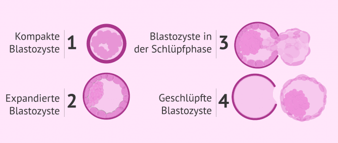 Imagen: Blastozystenentwicklung und Schlupf