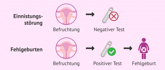 Imagen: Infertilität aufgrund von Einnistungsstörungen und Fehlgeburt