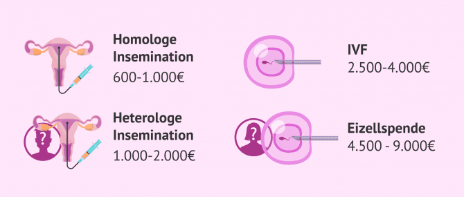 Imagen: Was kosten Kinderwunschbehandlungen?