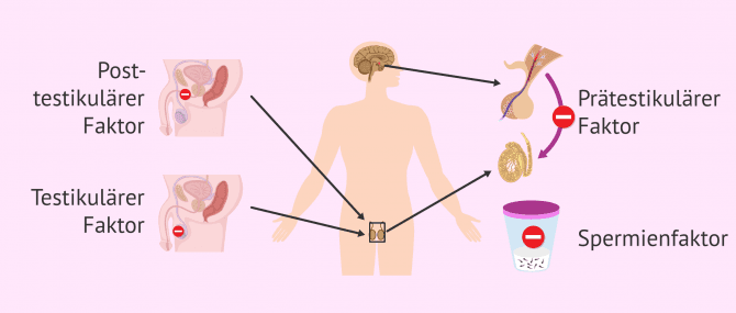 Imagen: Ursprung der männlichen Sterilität