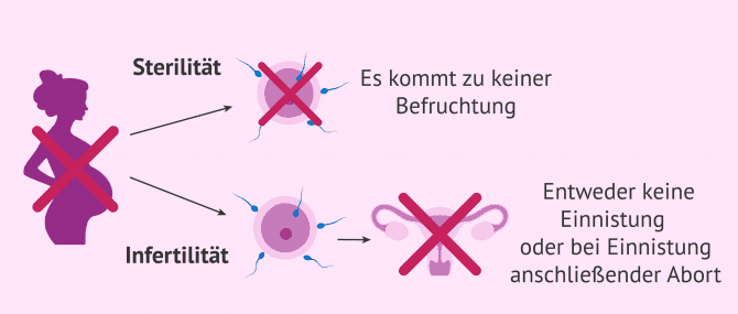 Imagen: Unterschied zwischen Sterilität und Infertilität