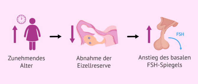 Imagen: Abnahme der ovariellen Reserve und Anstieg des FSH