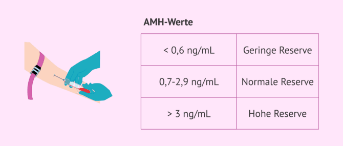 Imagen: Ergebnisse des Anti-Müller-Hormons