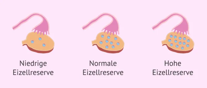 Imagen: Ergebnisse nach der Antralfollikelzählung