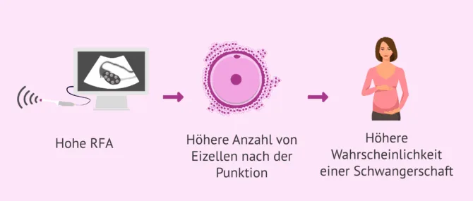 Imagen: Ovarielle Reserve und Ergebnisse in der assistierten Reproduktion