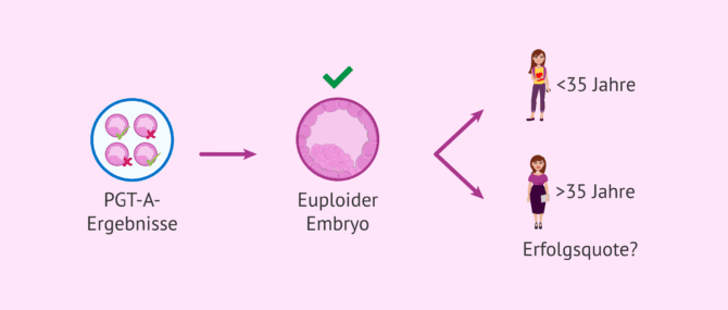 Imagen: Beeinflusst das Alter den Erfolg des Transfers von euploiden Embryonen?