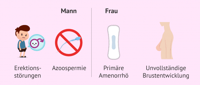 Imagen: Symptome beim Kallmann-Syndrom