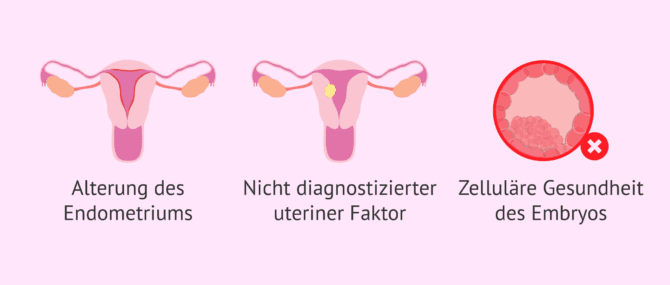 Imagen: Faktoren, die den Erfolg der IVF mit PGT beeinflussen
