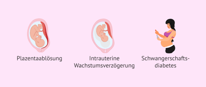 Imagen: Weitere mögliche Risiken einer Mutterschaft über 40