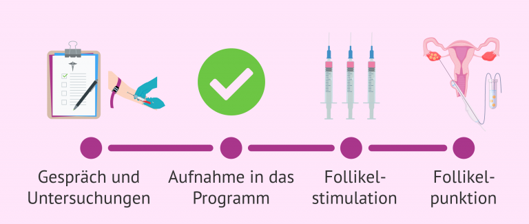 Wie kann ich meine Eizellen spenden? Eizellspende Schritt für Schritt