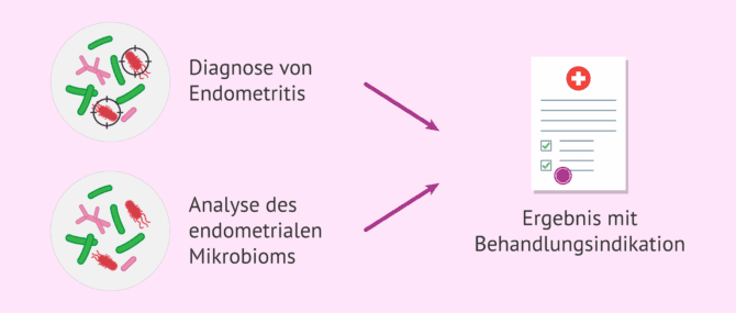 Imagen: Analyse des endometrialen Mikrobioms zur Förderung der Einnistung