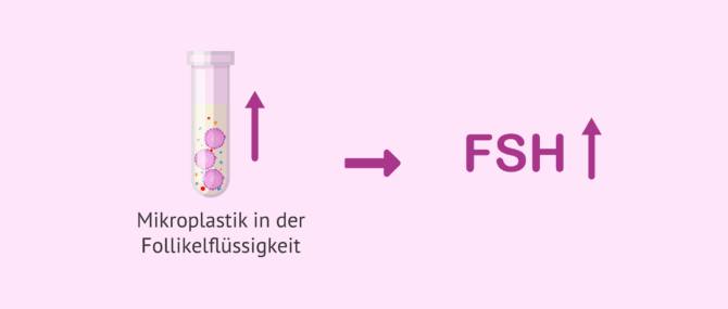 Imagen: Folgen von Mikroplastik in der Follikelflüssigkeit