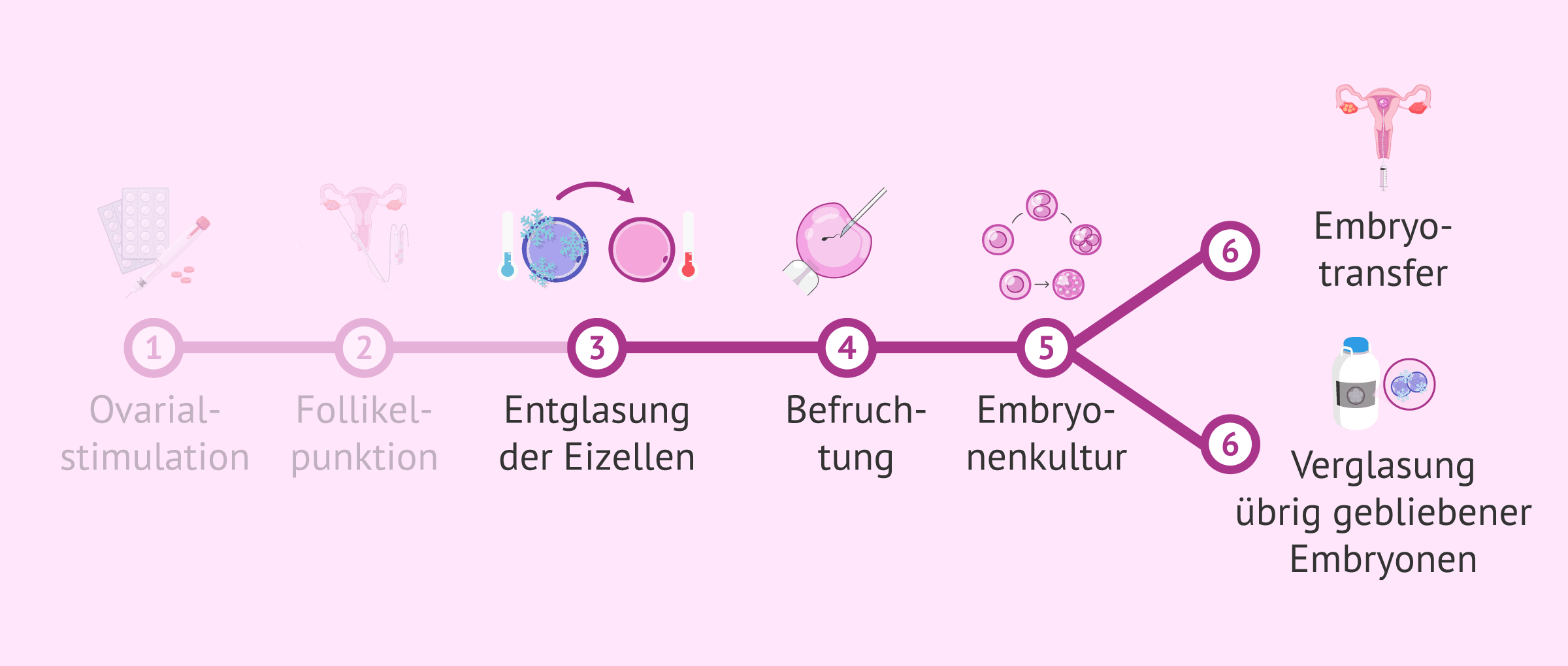 Was ist IVF mit vitrifizierten Eizellen und wie sind die Ergebnisse?
