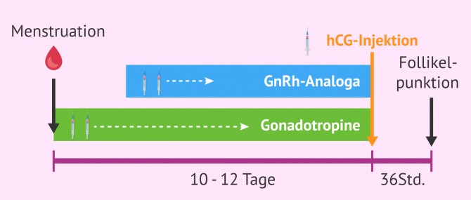 Imagen: Hormonbehandlung bei Eizellspenden