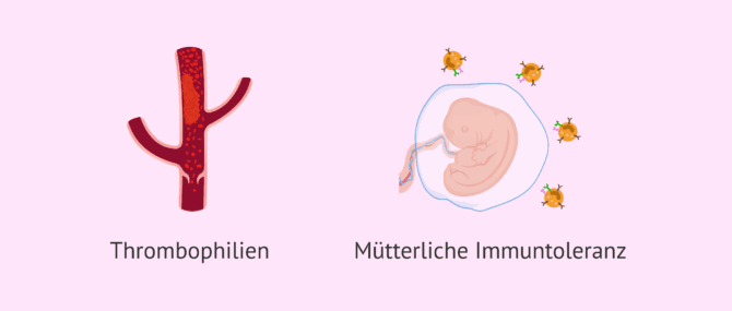 Imagen: Untersuchung auf Thrombophilie und immunologische Abklärung bei Einnistungsversagen