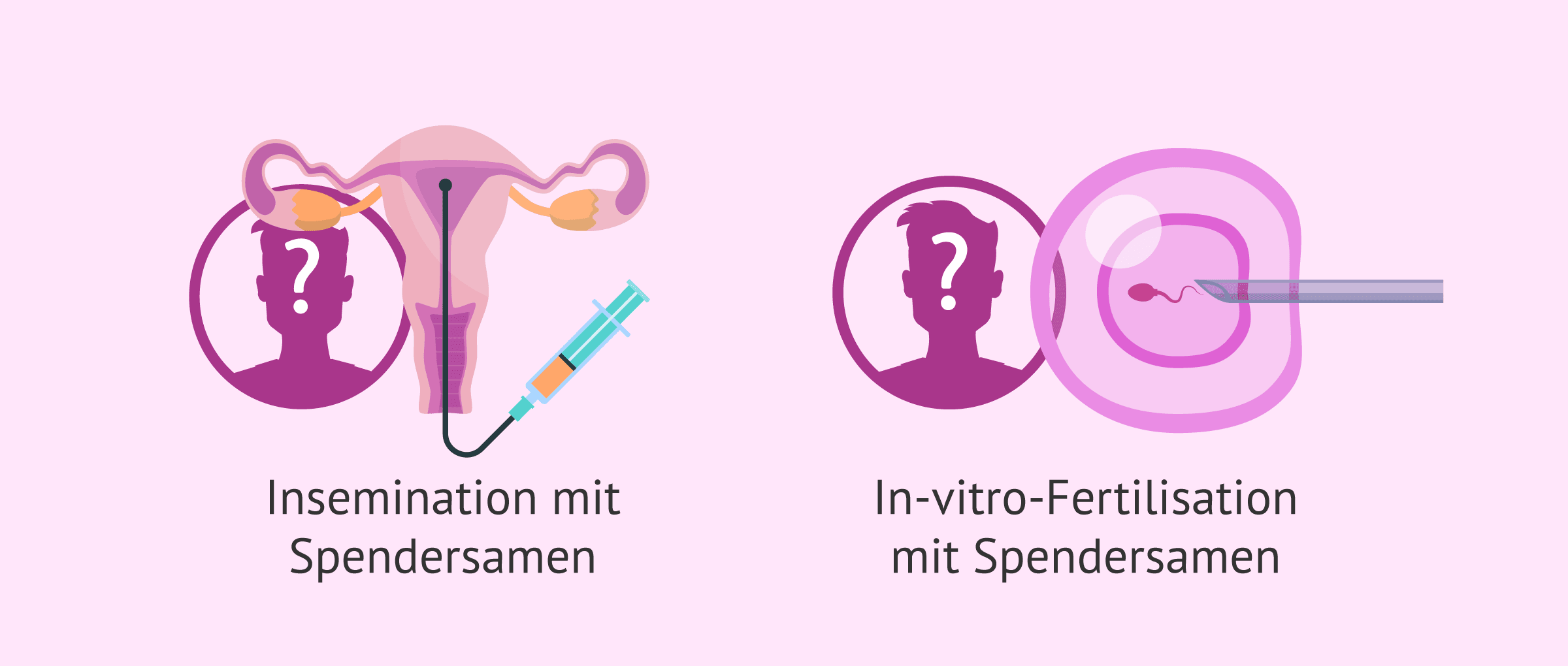 Imagen: Samenspende als Lösung für Azoospermie