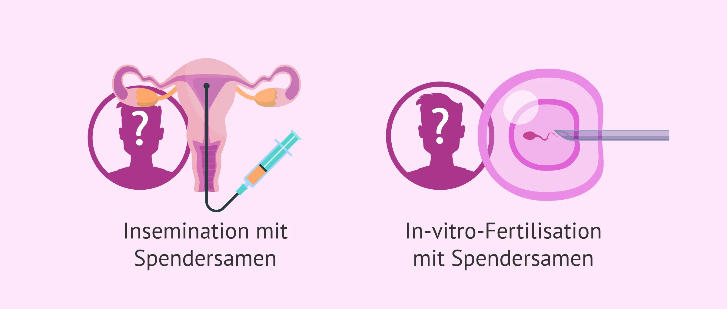 Imagen: Samenspende als Lösung für Azoospermie