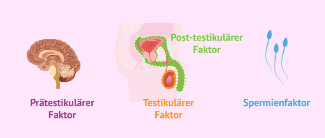 Imagen: Faktoren die zu Sterilität bei Männern führen