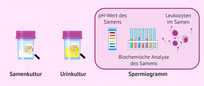 Imagen: Tests zur Diagnose von Sameninfektionen