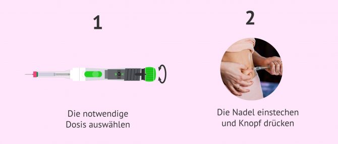 Imagen: Anwendung von Ovaleap