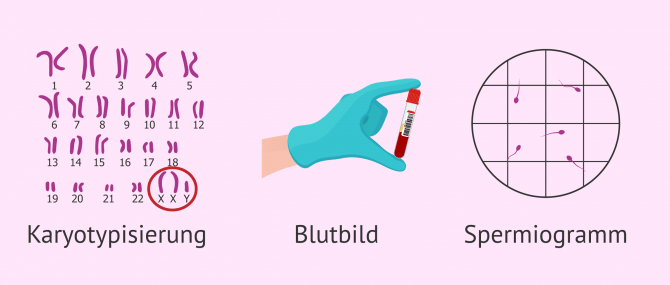 Imagen: Diagnostik bei Klinefelter-Syndrom