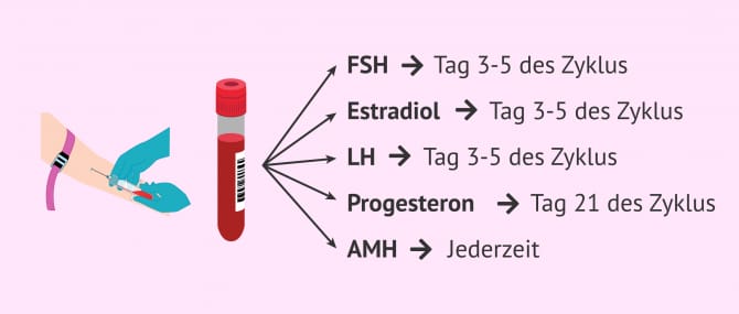 Imagen: Hormonuntersuchung