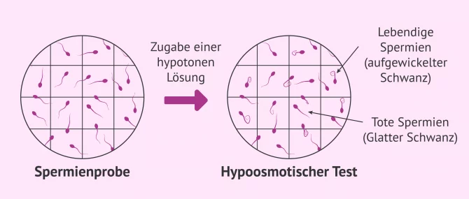 Osiyo lesbian porno onlayn Porno model video