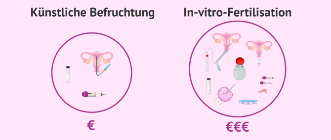 Imagen: Warum die IVF teurer ist als eine IUI