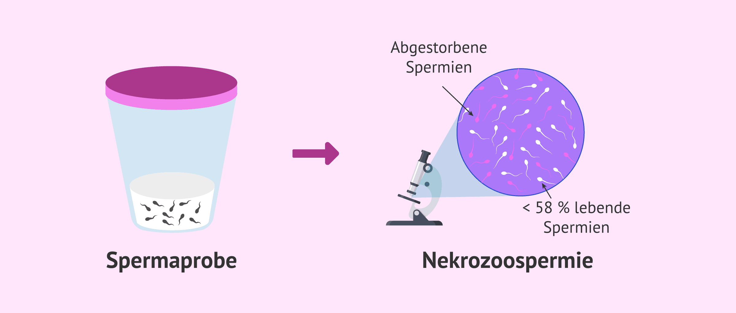 Imagen: Männliche Sterilität durch Nekrozoospermie