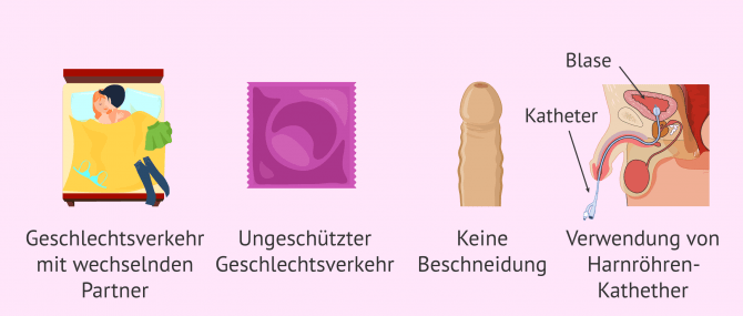 Imagen: Risikofaktoren Nebenhodenentzündung