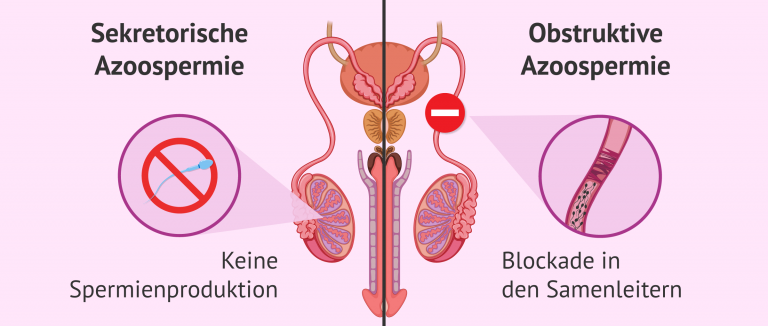 Wie Lange Leben Spermien Im Hoden www.invitra.de
