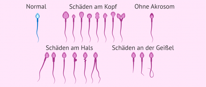 Imagen: Spermienmorphologie