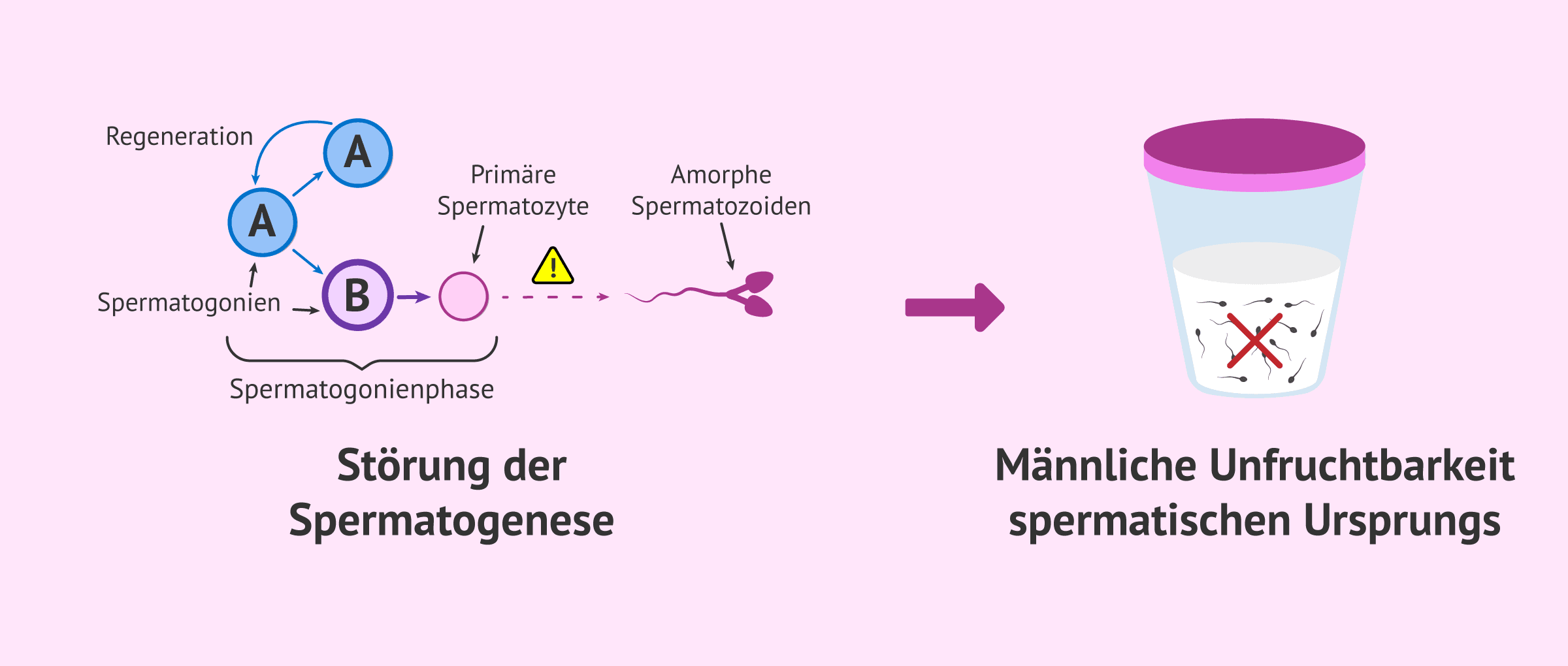 Imagen: Fehler bei der Spermatogenese verursachen männliche Unfruchtbarkeit