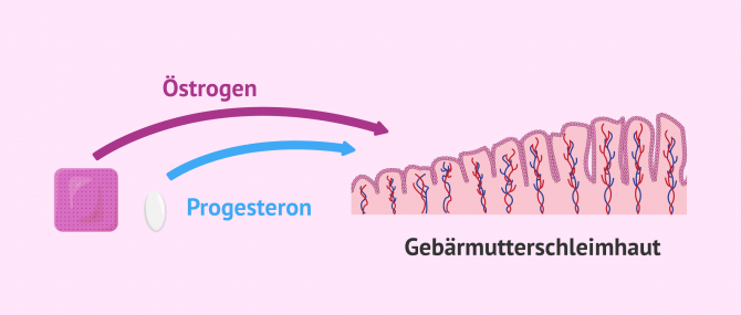 Imagen: Gebärmutterschleimhaut für den Ersatzzyklus vorbereiten