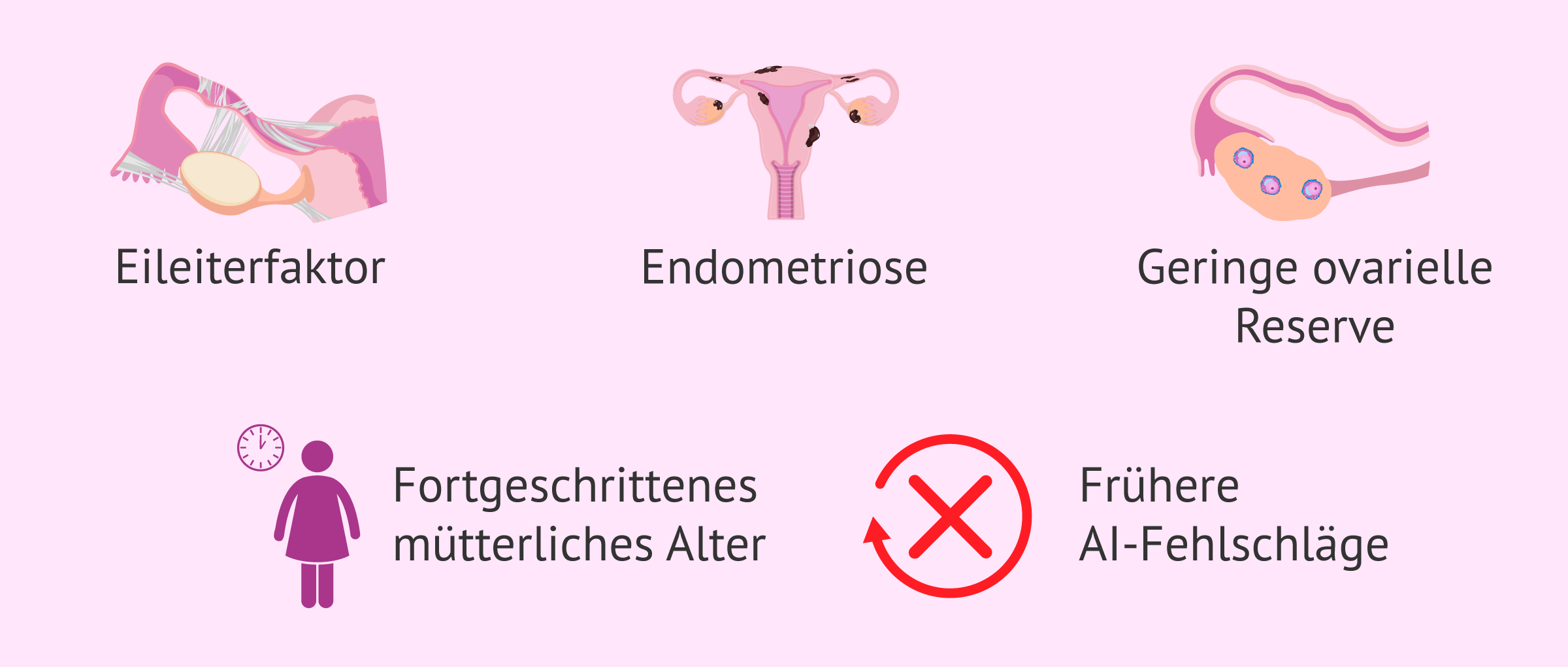 Imagen: IVF-Indikationen bei weiblicher Unfruchtbarkeit