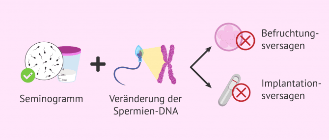 Imagen: Warum kommt es bei Normozoospermie nicht zu einer natürlichen Schwangerschaft?