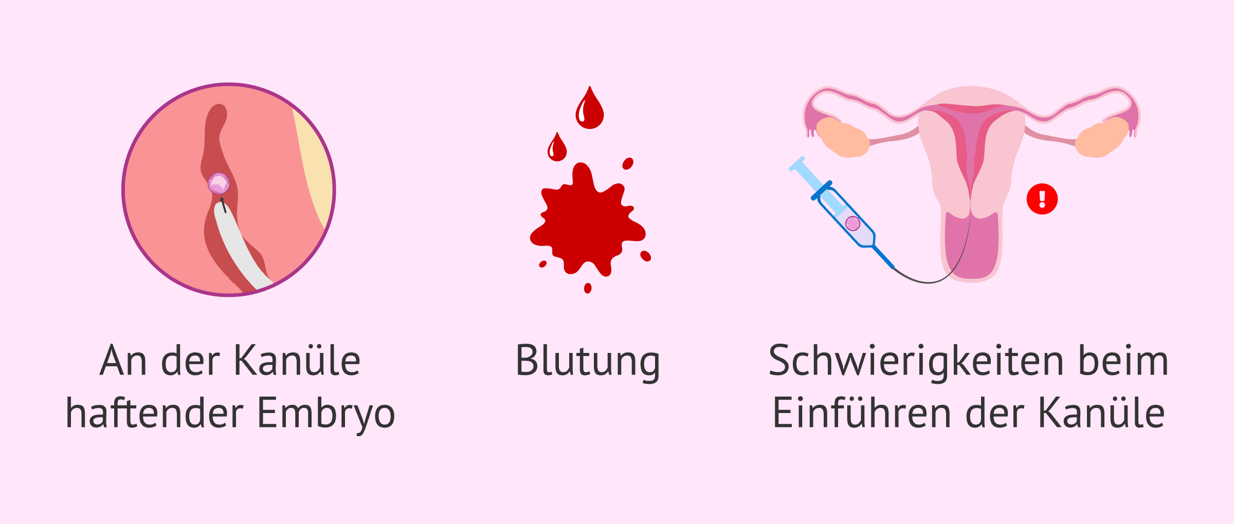 Welche Risiken bestehen bei einer Schwangerschaft durch Eizellspende?