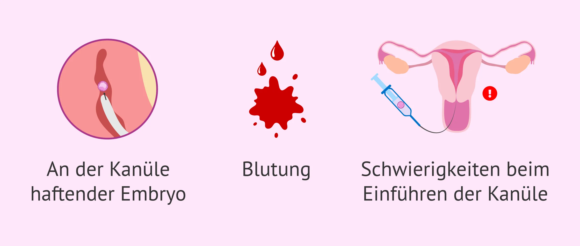 Welche Risiken bestehen bei einer Schwangerschaft durch Eizellspende?