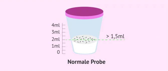 Imagen: Untersuchung der ejakulierten Spermienmenge