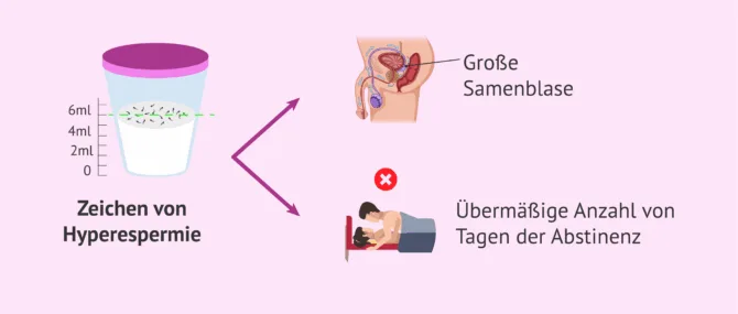 Imagen: Ursachen für Hyperespermie
