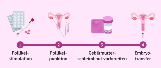 Welche Symptome tauchen nach einem Embryotransfer auf?