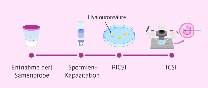 Imagen: Ablauf der PICSI