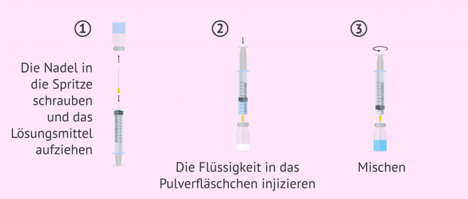 Imagen: Erste Schritte bei der Vorbereitung von Luveris