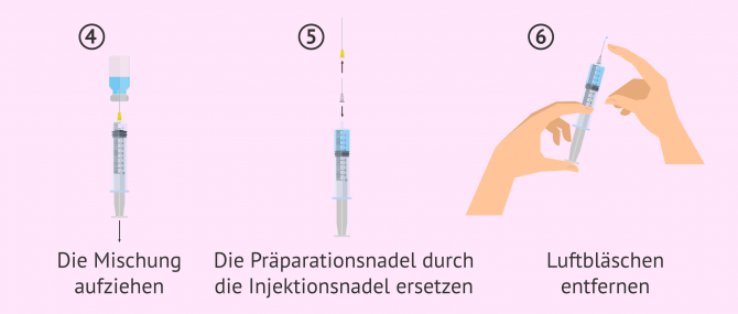 Imagen: Letzte Schritte bei der Vorbereitung von Luveris