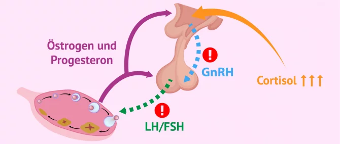 Imagen: Veränderungen in der Hypothalamus-Hypophysen-Ovarien-Achse bei Frauen mit Stress