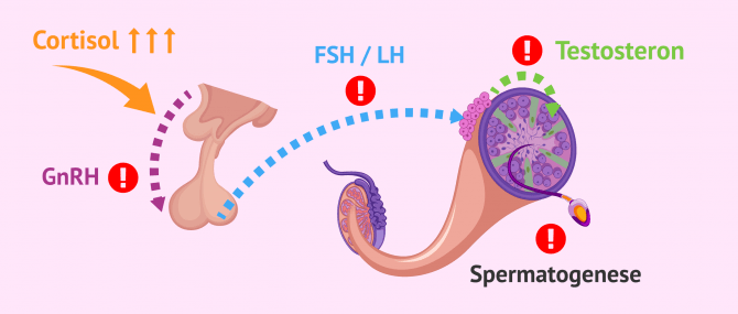 Imagen: Störungen der Hypothalamus-Hypophysen-Hodenachse bei Männern unter Stress