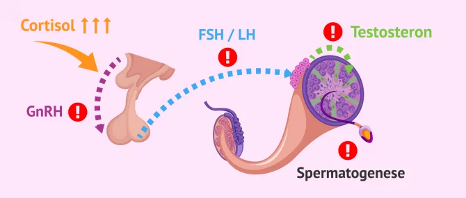 Imagen: Störungen der Hypothalamus-Hypophysen-Hodenachse bei Männern unter Stress