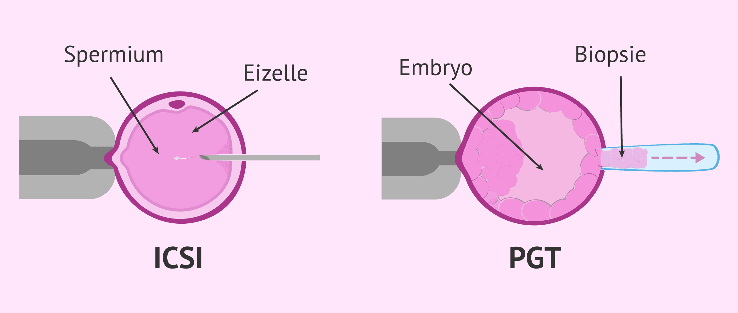 Imagen: Ergänzende Techniken bei der IVF